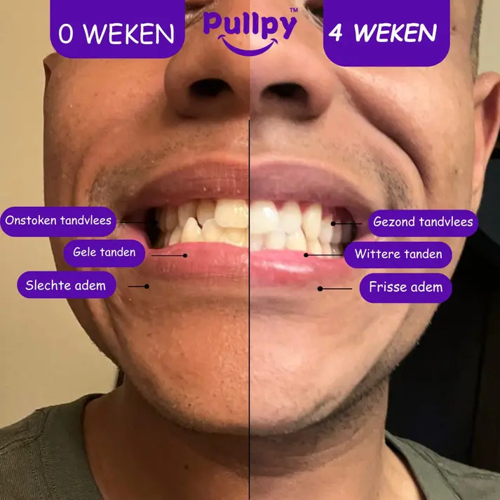 Productafbeelding 2